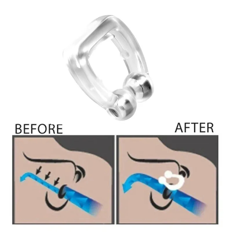 1/2/3/4/5/6 Stuks Anti Snurken - Anti Snore Contour Pillow recensie en prijs