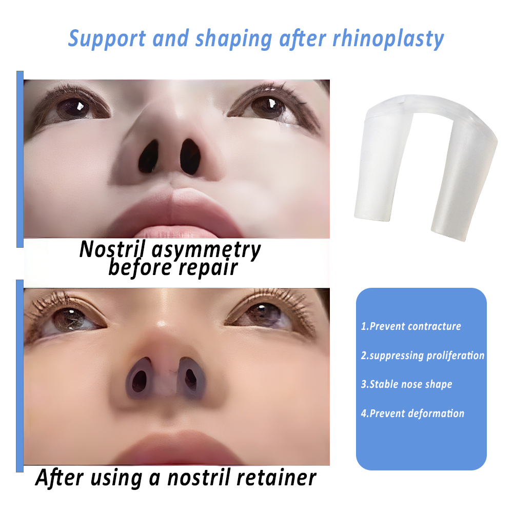 Neusgathouder voor post-neinco - Anti Snore Contour Pillow recensie en prijs